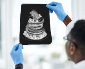 A medical professional holds up an X-ray of a stack of pancakes with berries on top